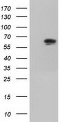 IGF2BP2 Mouse anti-Canine, Human, Clone: OTI3F9, lyophilized, TrueMAB 100