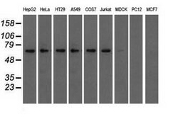 IGF2BP2 Mouse anti-Canine, Human, Clone: OTI3F9, lyophilized, TrueMAB 100