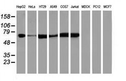 IGF2BP2 Monoclonal Antibody (OTI6C4), TrueMAB , OriGene 30 &mu;L; Unconjugated:Antibodies,
