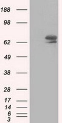 IGF2BP2 Mouse anti-Human, Clone: OTI3C8, lyophilized, TrueMAB 100 &mu;g;