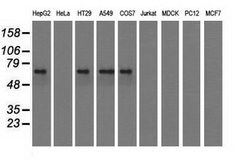 IGF2BP2 Mouse anti-Human, Clone: OTI3C8, lyophilized, TrueMAB 100 &mu;g;