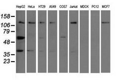 IGF2BP2 Mouse anti-Human, Clone: OTI4D10, lyophilized, TrueMAB 100 &mu;g;
