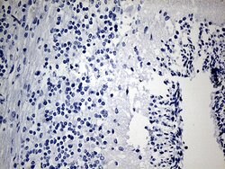 IGF2BP3 Mouse anti-Human, Clone: OTI7B10, lyophilized, TrueMAB 100 &mu;g;