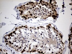 IGF2BP3 Mouse anti-Human, Clone: OTI7B10, lyophilized, TrueMAB 100 &mu;g;