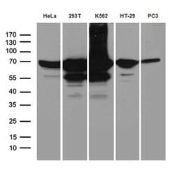 IGF2BP3 Mouse anti-Human, Clone: OTI4H5, liquid, TrueMAB 100 &mu;L; Unconjugated:Antibodies,
