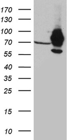 IGF2BP3 Mouse anti-Human, Clone: OTI7B10, lyophilized, TrueMAB 100 &mu;g;