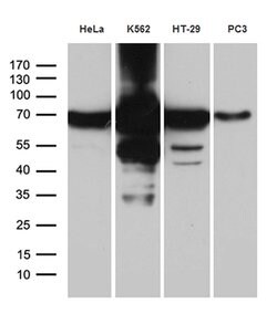 IGF2BP3 Mouse anti-Human, Clone: OTI7B10, lyophilized, TrueMAB 100 &mu;g;