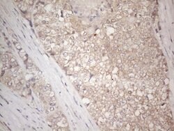 IGFBP1 Monoclonal Antibody (OTI6C7), TrueMAB , OriGene 100 &mu;L; Unconjugated:Antibodies,