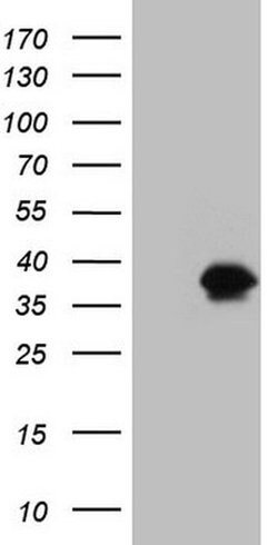 IGFBP1 Monoclonal Antibody (OTI6H10), TrueMAB , OriGene 100 &mu;L; Unconjugated:Antibodies,