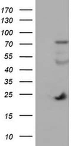 IGJ Monoclonal Antibody (OTI3F8), TrueMAB , OriGene 100 &mu;L; Unconjugated:Antibodies,