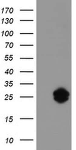 IGJ Mouse anti-Human, Clone: OTI3H7, liquid, TrueMAB 100 &mu;L; Unconjugated:Antibodies,