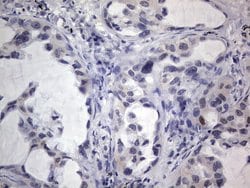 IGSF11 Monoclonal Antibody (OTI3A4), TrueMAB , OriGene 100 &mu;L; Unconjugated:Antibodies,