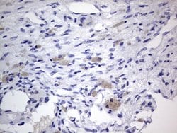 IGSF11 Monoclonal Antibody (OTI3A4), TrueMAB , OriGene:Antibodies:Primary