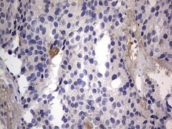 IGSF11 Monoclonal Antibody (OTI3A4), TrueMAB , OriGene 100 &mu;L; Unconjugated:Antibodies,