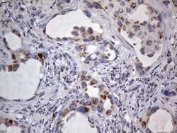 IGSF11 Mouse anti-Human, Clone: OTI2H1, lyophilized, TrueMAB 100 &mu;g;