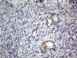 IGSF11 Mouse anti-Human, Clone: OTI2H1, lyophilized, TrueMAB 100 &mu;g;