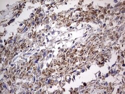IGSF11 Mouse anti-Human, Clone: OTI2H1, lyophilized, TrueMAB 100 &mu;g;