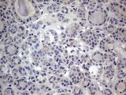 IGSF11 Mouse anti-Human, Clone: OTI2H1, lyophilized, TrueMAB 100 &mu;g;