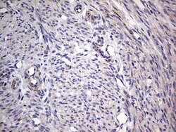 IGSF11 Mouse anti-Human, Clone: OTI2H1, lyophilized, TrueMAB 100 &mu;g;