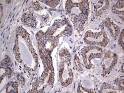IGSF11 Mouse anti-Human, Clone: OTI2H1, lyophilized, TrueMAB 100 &mu;g;