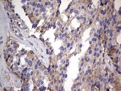 IGSF11 Mouse anti-Human, Clone: OTI2H1, lyophilized, TrueMAB 100 &mu;g;