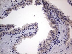 IGSF11 Mouse anti-Human, Clone: OTI2H1, lyophilized, TrueMAB 100 &mu;g;