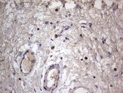 IGSF11 Mouse anti-Human, Clone: OTI2H1, lyophilized, TrueMAB 100 &mu;g;