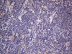 IGSF11 Mouse anti-Human, Clone: OTI2H1, lyophilized, TrueMAB 100 &mu;g;