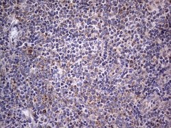 IGSF11 Mouse anti-Human, Clone: OTI2H1, lyophilized, TrueMAB 100 &mu;g;
