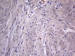 IGSF11 Mouse anti-Human, Clone: OTI2H1, lyophilized, TrueMAB 100 &mu;g;
