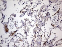 IGSF11 Mouse anti-Human, Clone: OTI2H1, lyophilized, TrueMAB 100 &mu;g;