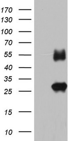 IGSF11 Monoclonal Antibody (OTI1B9), TrueMAB , OriGene 30 &mu;L; Unconjugated:Antibodies,