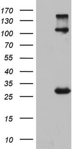 IGSF11 Monoclonal Antibody (OTI3A4), TrueMAB , OriGene:Antibodies:Primary