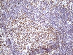IKBKE Monoclonal Antibody (OTI3C5), TrueMAB , OriGene 100 &mu;L; Unconjugated:Antibodies,