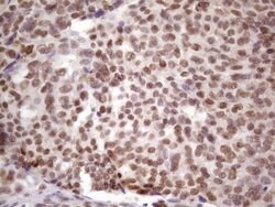 IKBKE Monoclonal Antibody (OTI3C5), TrueMAB , OriGene 100 &mu;L; Unconjugated:Antibodies,