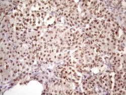 IKBKE Monoclonal Antibody (OTI3C5), TrueMAB , OriGene 100 &mu;L; Unconjugated:Antibodies,