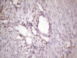 IKBKE Monoclonal Antibody (OTI3C5), TrueMAB , OriGene 100 &mu;L; Unconjugated:Antibodies,