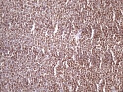 IKBKE Monoclonal Antibody (OTI3C5), TrueMAB , OriGene:Antibodies:Primary