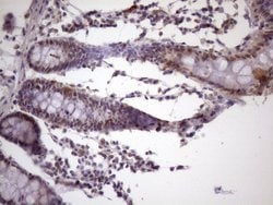 IKBKE Monoclonal Antibody (OTI3C5), TrueMAB , OriGene:Antibodies:Primary