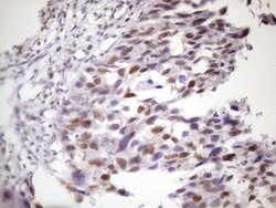 IKBKE Monoclonal Antibody (OTI3C5), TrueMAB , OriGene 100 &mu;L; Unconjugated:Antibodies,