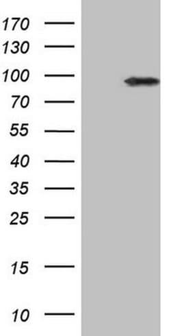 IKBKE Monoclonal Antibody (OTI4F9), TrueMAB , OriGene:Antibodies:Primary