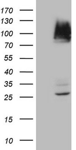 IKBKE Mouse anti-Human, Clone: OTI1E4, lyophilized, TrueMAB 100 &mu;g;