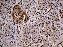 IKBKG Monoclonal Antibody (OTI3C3), TrueMAB , OriGene:Antibodies:Primary