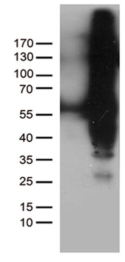 IKBKG Mouse anti-Human, Clone: OTI2F2, lyophilized, TrueMAB 100 &mu;g;