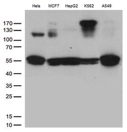 IKBKG Mouse anti-Human, Clone: OTI2F2, lyophilized, TrueMAB 100 &mu;g;