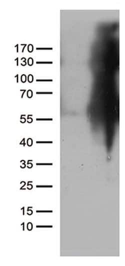 IKBKG Monoclonal Antibody (OTI3C3), TrueMAB , OriGene 100 &mu;L; Unconjugated:Antibodies,