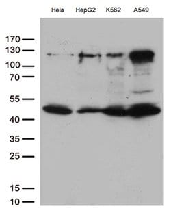 IKBKG Monoclonal Antibody (OTI3C3), TrueMAB , OriGene:Antibodies:Primary