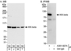 IKK-beta Rabbit anti-Human, Polyclonal, Bethyl Laboratories 100 &mu;L;