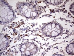 IKZF3 Monoclonal Antibody (OTI5E2), TrueMAB , OriGene 100 &mu;L; Unconjugated:Antibodies,