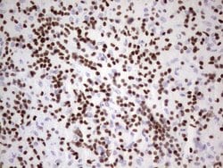 IKZF3 Monoclonal Antibody (OTI4H7), TrueMAB , OriGene 100 &mu;L; Unconjugated:Antibodies,